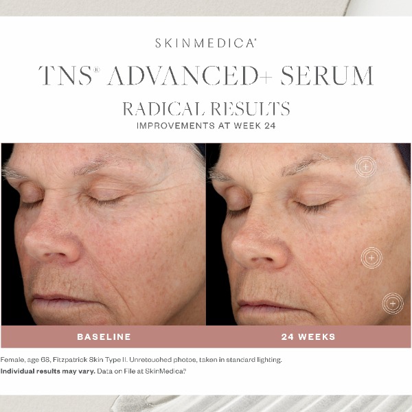 SkinMedica purchases TNS advanced Serum 1oz EXP 06/24