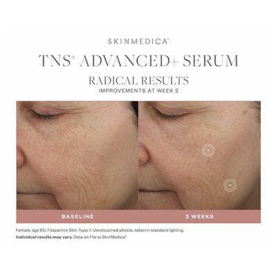 Skinmedica Tns Advanced+ Serum 