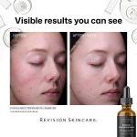Revision Skincare Radiance + Resurfacing Serum (1 OZ.) - Image 3